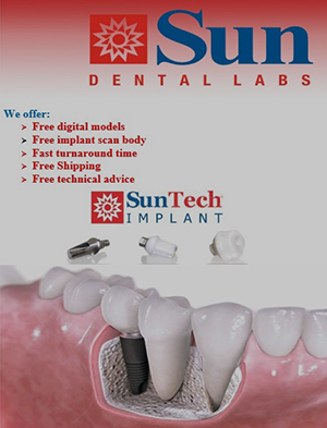 Sun Dental Labs'' Implants