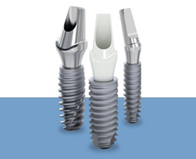 Dental Implants