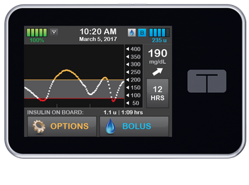 Insulin Pump