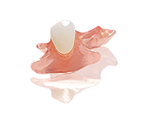 SunFlex&reg; Unilateral Partial Dentures