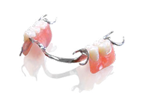 SunFlex&reg; Combination with Cast Partial Dentures