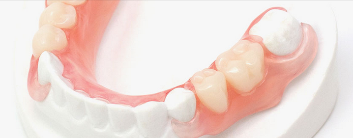 Lightweight, Comfortable Dental Partials