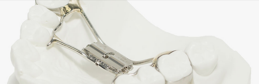 Orthodontic Fixed Appliances