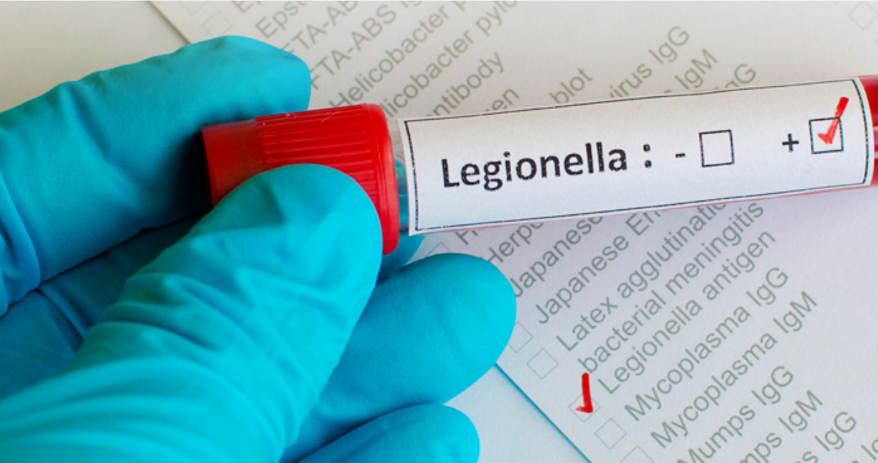 Legionella Risk Assessments